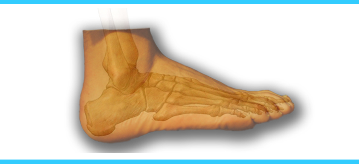 A foot with an image of the bone in it.